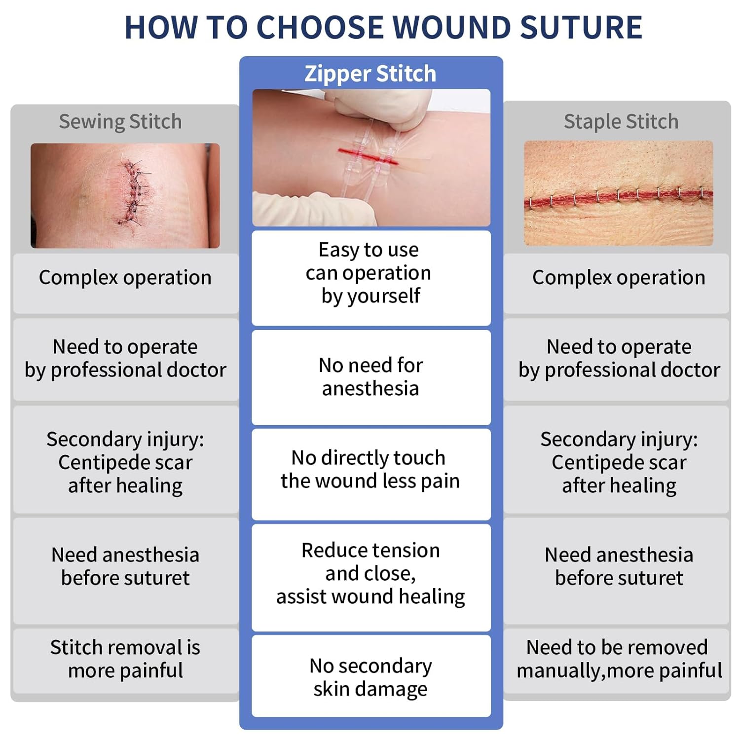Zip Tie Suture Wound Closure Device – 7x6 cm Zipper Stitch Bandage for Emergency Cuts & Lacerations - Image 5